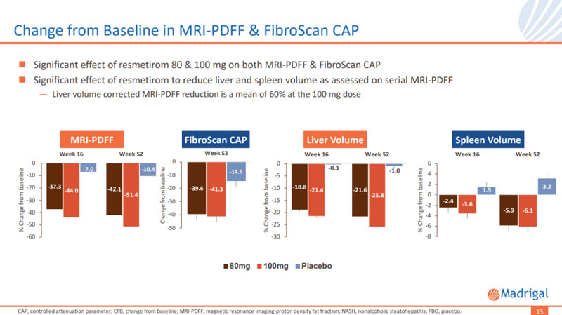 Significant effect of resmetirom in MRI-PDFF and Fibroscan CAP 