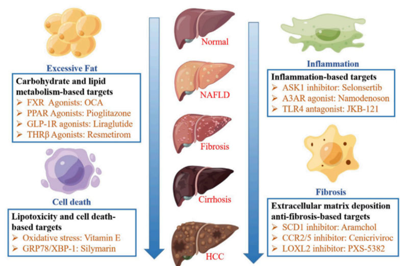 NASH-treatment-types